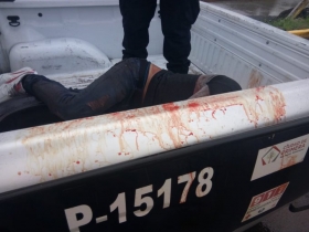 La poblaci&oacute;n est&aacute; harta de la inseguridad en la zona 